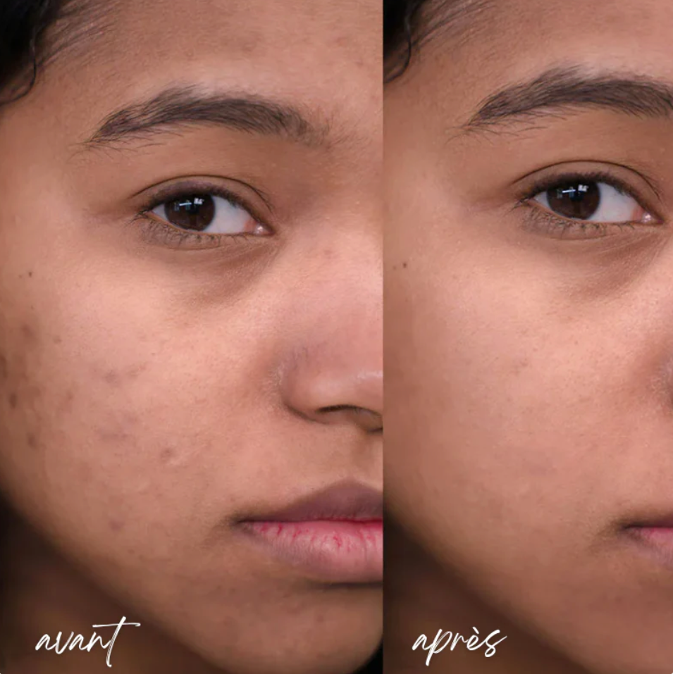 Luméva - Elixir rajeunissant visage