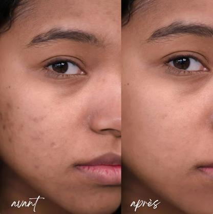 Luméva - Elixir rajeunissant visage