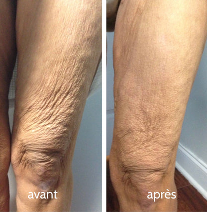 Luméva - Huile corporelle Rajeunissante