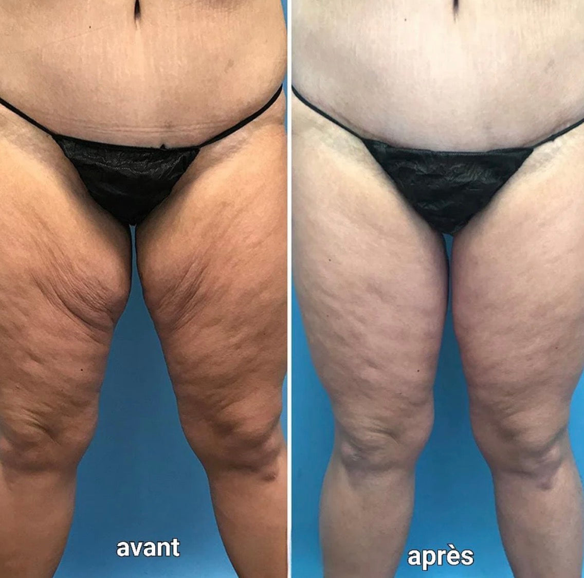 Luméva - Huile corporelle Rajeunissante