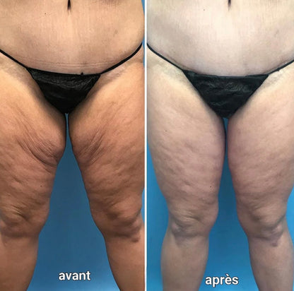 Luméva - Huile corporelle Rajeunissante