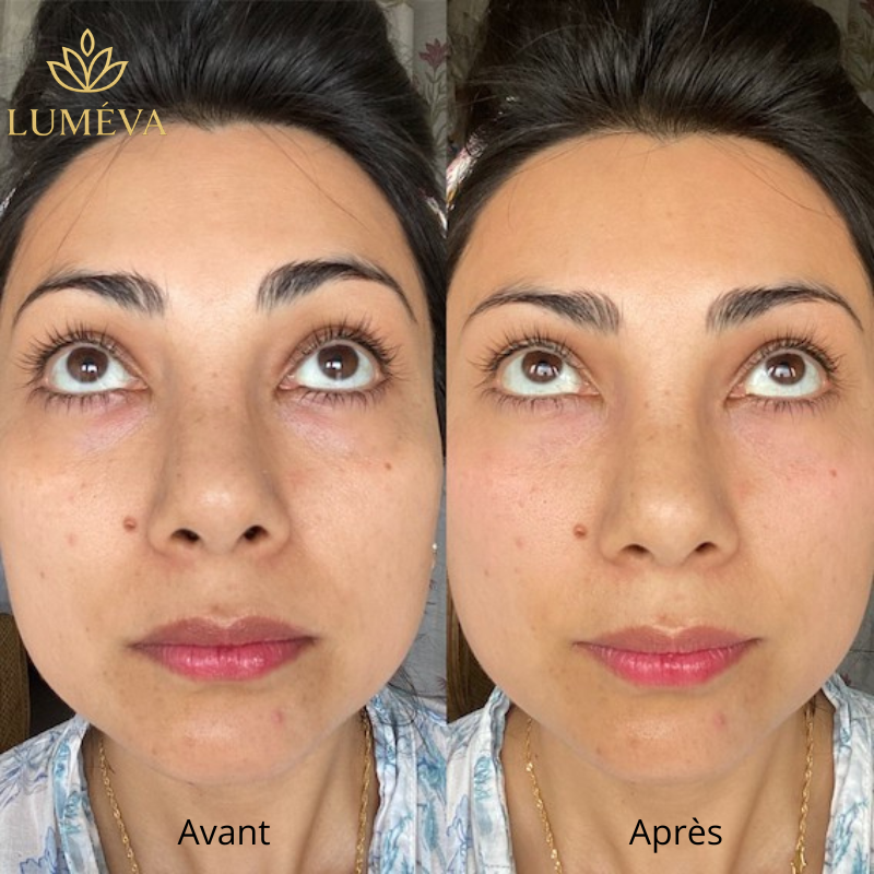 Luméva - Kit massant